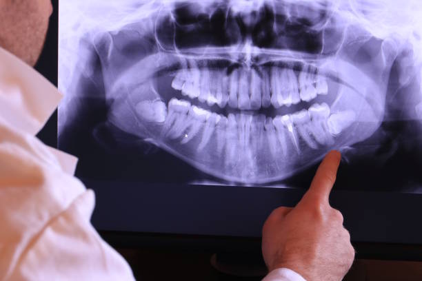 Best Emergency Tooth Extraction in Shawnee Hills, OH