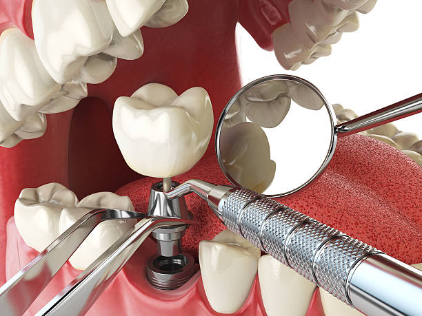 Best Pediatric Emergency Dentist in Shawnee Hills, OH